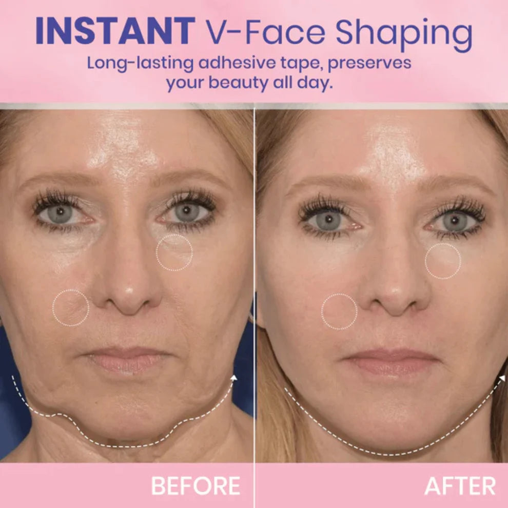 ContourVeil™ Face Lift Film