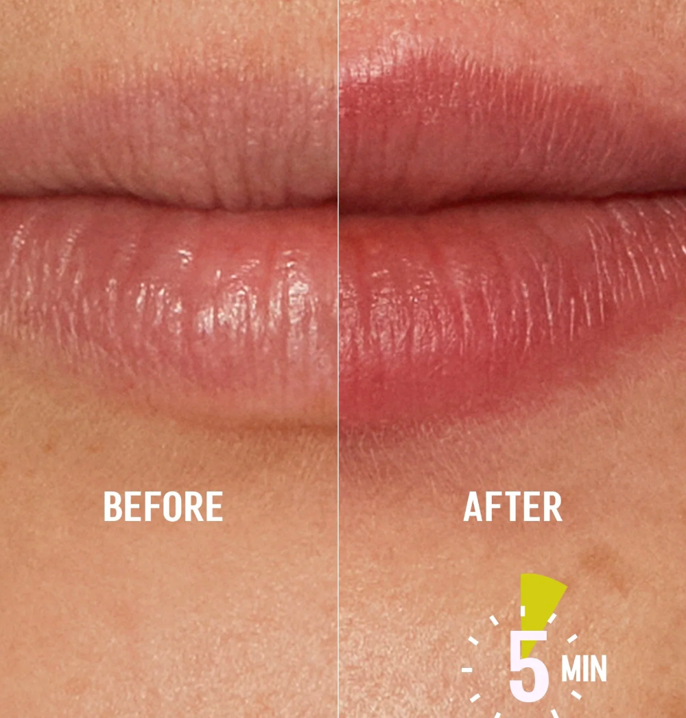 LippenForm™ Klarliner